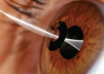 Οι ειδικοί προειδοποιούν: 1 στους 4 ασθενείς με διαβήτη κινδυνεύουν να χάσουν την όρασή τους
