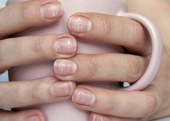 Τι σημαίνουν οι γραμμές στα νύχια σας – Πότε πρέπει να απευθυνθείτε σε γιατρό