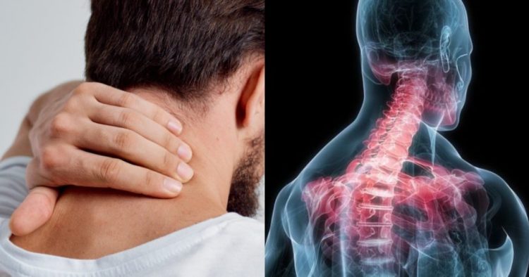 Πόνος στον αυχένα: 4 λόγοι που υποφέρετε – Tips πρόληψης