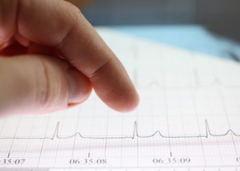 O κορωνοϊός αυξάνει για μήνες τον κίνδυνο καρδιακής αρρυθμίας – Νέα ευρήματα