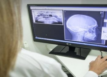 Κρήτη: Άνδρας δέχθηκε σφαίρα στον εγκέφαλο και κατάφερε να επιβιώσει