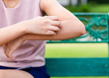 Αυτές είναι οι δερματικές παθήσεις που βελτιώνονται το καλοκαίρι