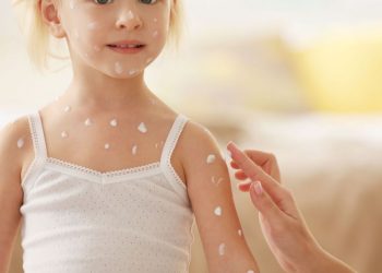 Κρέμες κορτιζόνης – Πότε να τις χρησιμοποιούν οι γονείς και γιατί δεν πρέπει να κάνουν κατάχρηση