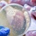 E.coli, λιστέρια, σαλμονέλα: Γιατί αυξάνονται κρούσματα και ανακλήσεις τροφίμων σε όλο τον κόσμο