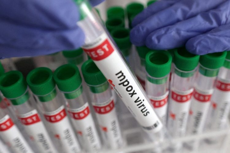 Αύξηση των κρουσμάτων mpox στην Ελλάδα: Τι πρέπει να γνωρίζουμε
