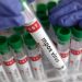 Αύξηση των κρουσμάτων mpox στην Ελλάδα: Τι πρέπει να γνωρίζουμε