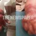 Συγκλονίζει ο πατέρας του 3μηνου βρέφους που υπέστη εγκαύματα από λάθος ορό στο Νοσοκομείο Βόλου