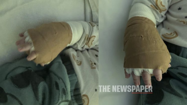 Απίστευτο θράσος στο νοσοκομείο Βόλου: Ζητάνε χρήματα από τους γονείς του βρέφους που του κατέστρεψαν το χέρι – Τι λέει ο πατέρας του