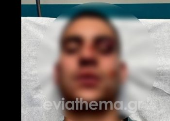 Χαλκίδα: 18χρονος έστειλε στο νοσοκομείο με κατάγματα 19χρονο για ένα like