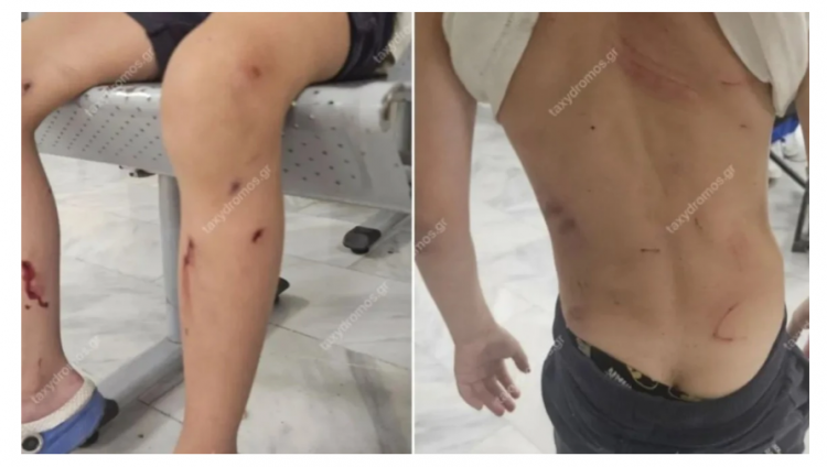 Από θαύμα γλίτωσε 7χρονος όταν του επιτέθηκαν αδέσποτα σκυλιά – Παραλίγο να το κατασπαράξουν, λέει η μητέρα του (ΕΙΚΟΝΑ)