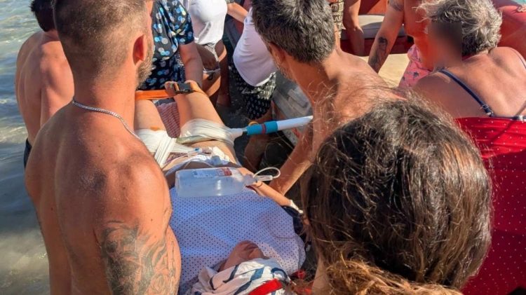 Σοκαριστικό περιστατικό: Ο αέρας σήκωσε ομπρέλα και την κάρφωσε στο πόδι κοπέλας από την Θεσσαλία – Ανατριχιαστικές εικόνες