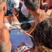 Σοκαριστικό περιστατικό: Ο αέρας σήκωσε ομπρέλα και την κάρφωσε στο πόδι κοπέλας από την Θεσσαλία – Ανατριχιαστικές εικόνες