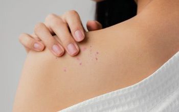 Η ασθένεια που προκαλείται και από το άγχος και την οποία λίγοι γνωρίζουν