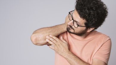 Ψωρίαση: Ανακαλύψτε τη βιταμίνη που αποτελεί φυσικό σύμμαχο για το δέρμα