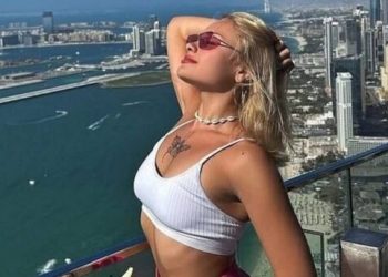 Πάρτι «porta potty»: Σε αμαξίδιο η Ουκρανή influencer – Της λείπουν 10 εκατοστά οστού από το πόδι