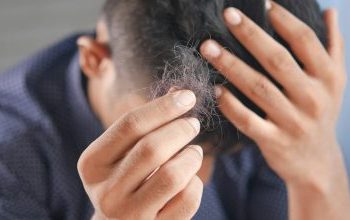Οι τροφές που προκαλούν τριχόπτωση, σύμφωνα με τους ειδικούς