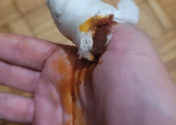 Γνωστός Τρικαλινός ηθοποιός θύμα άγριας ληστείας στην Αθήνα-Τον μαχαίρωσαν και τον άφησαν αιμόφυρτο