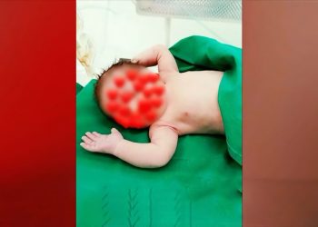 Πως έγινε το ατύχημα του βρέφους με το καυτό λάδι – «Η μητέρα πήγε να πετάξει την πάνα»