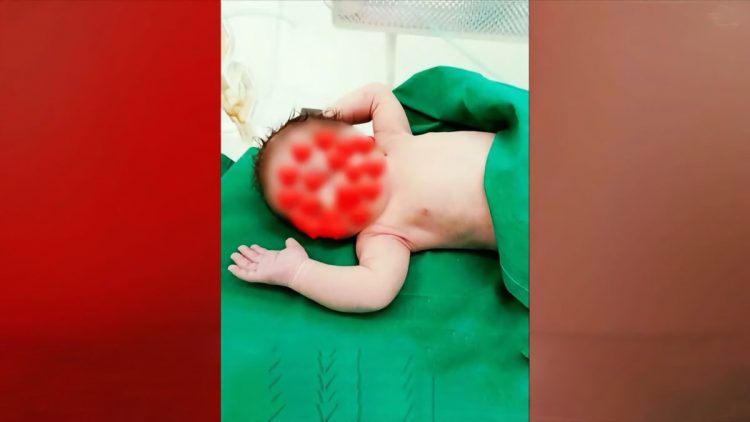 Πως έγινε το ατύχημα του βρέφους με το καυτό λάδι – «Η μητέρα πήγε να πετάξει την πάνα»