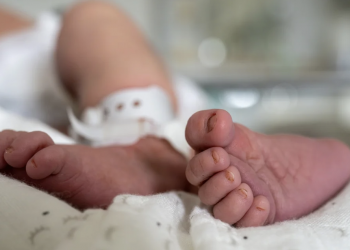 Λάρισα: Βρέφος νοσηλεύεται σε ΜΕΘ με εγκαύματα από καυτό λάδι -Εξαιρετικά κρίσιμη η κατάστασή του