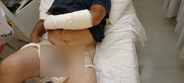 Εζησε τον απόλυτο εφιάλτη στα σαγόνια σκύλων – Tον δάγκωσαν σε χέρι και γεννητικά όργανα!!