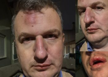 Ξυλοδαρμός του εκδότη της ΜΑΓΝΗΣΙΑΣ – Γρονθοκόπησαν τον Αρχιμήδη Καρεκλίδη έξω από το σπίτι του (ΕΙΚΟΝΕΣ)
