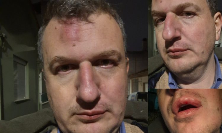 Ξυλοδαρμός του εκδότη της ΜΑΓΝΗΣΙΑΣ – Γρονθοκόπησαν τον Αρχιμήδη Καρεκλίδη έξω από το σπίτι του (ΕΙΚΟΝΕΣ)