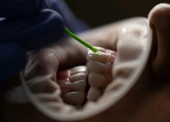 Πώς μία λοίμωξη στο δόντι μπορεί να επηρεάσει την καρδιά