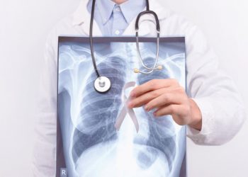 Αυξάνεται ο καρκίνος του πνεύμονα σε μη καπνιστές: Αιτίες και πρώιμα συμπτώματα που πολλοί υποτιμούν