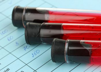 Οι 4 πρωτοπαθείς καρκίνοι που αυξάνουν την πιθανότητα μετέπειτα λευχαιμίας