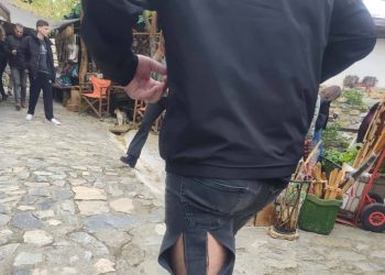 Διπλή επίθεση σκύλου – Τρόμος για άνδρα, του έσκισε το παντελόνι και του προκάλεσε τραυματισμό (φωτο)