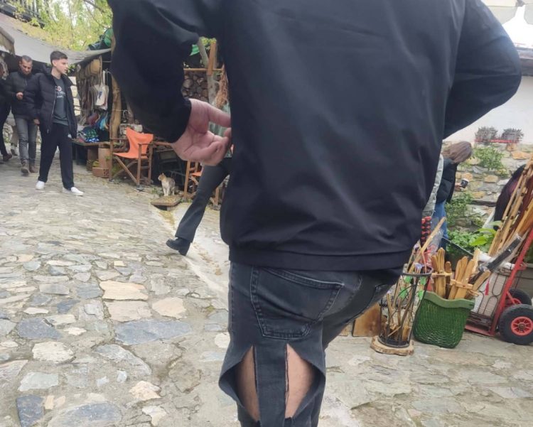 Διπλή επίθεση σκύλου – Τρόμος για άνδρα, του έσκισε το παντελόνι και του προκάλεσε τραυματισμό (φωτο)