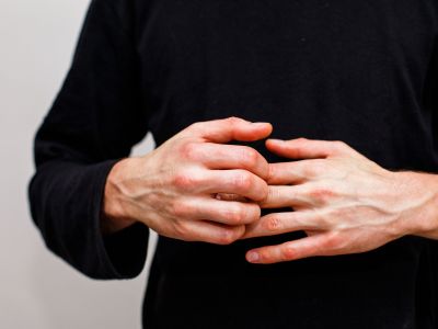 Εξάνθημα Χασιμότο: Πώς μοιάζει το σημάδι θυρεοειδίτιδας στο δέρμα
