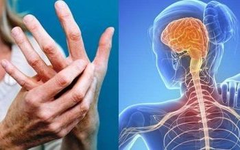 Σκλήρυνση κατά Πλάκας: Τα 9 σημάδια που συχνά εμφανίζονται πριν από τη διάγνωση