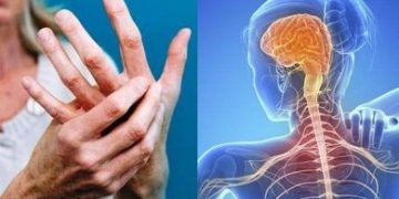 Σκλήρυνση κατά Πλάκας: Τα 9 σημάδια που συχνά εμφανίζονται πριν από τη διάγνωση