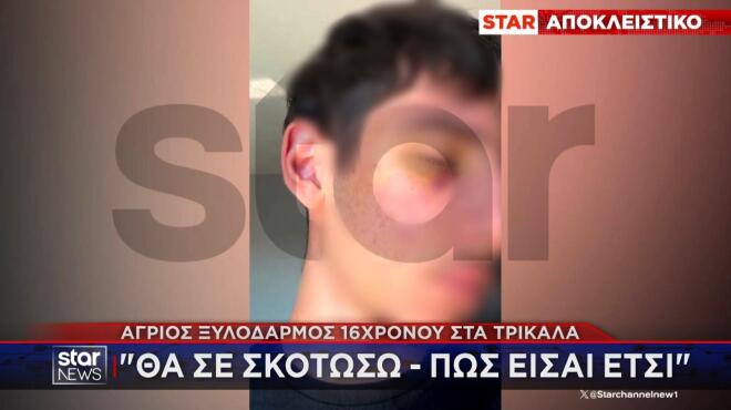 Άγριος ξυλοδαρμός 16χρονου από συνομήλικό του σε πανηγύρι στα Τρίκαλα – «Εγώ εσένα θα σε σκοτώσω»